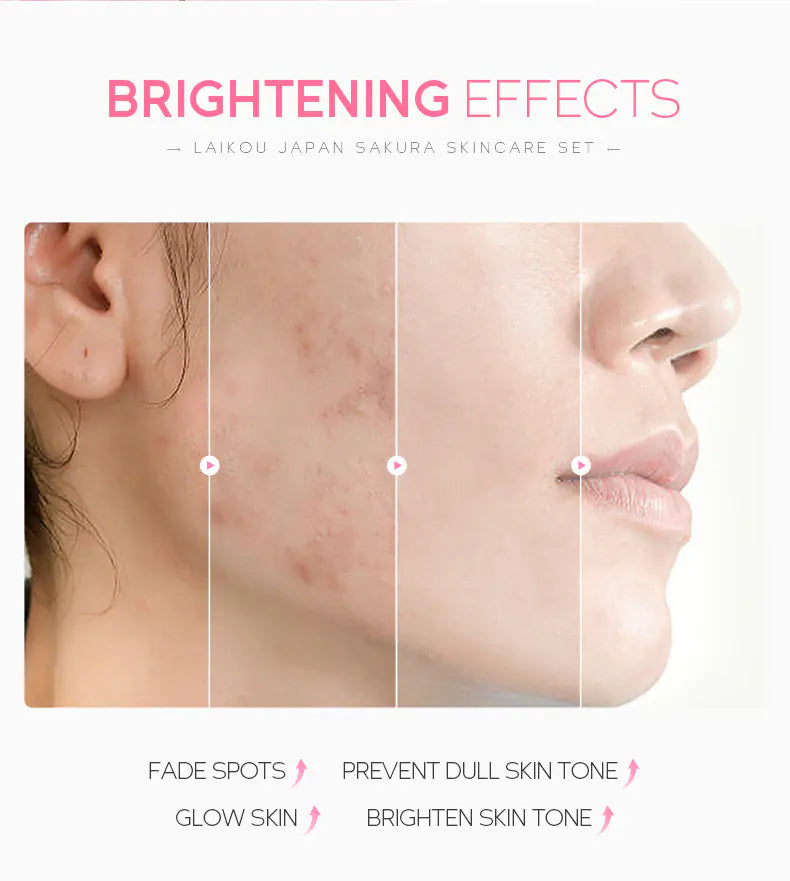 Hydrating Face Cream 5-Piece Skincare Set